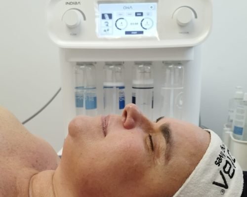 ONA by INDIBA® – Limpieza facial profunda SIN dolor